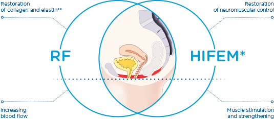 Pelvic floor muscles after Emsella treatment